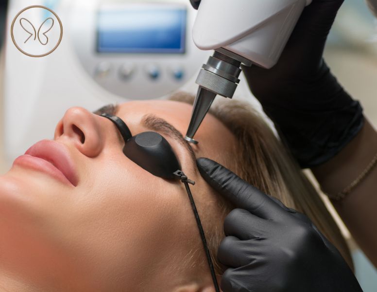 Laser Tattoo Removal Edmonton – Renée Beauté Studio & Academy Laser tattoo removal treatment at Renée Beauté Studio in Edmonton